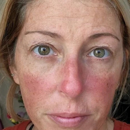 Marie, 37
