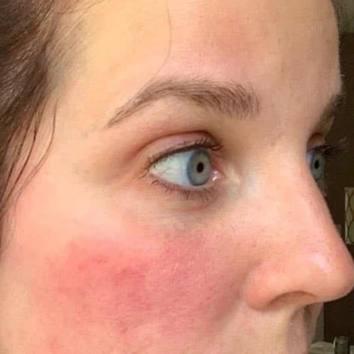 Dana, 29