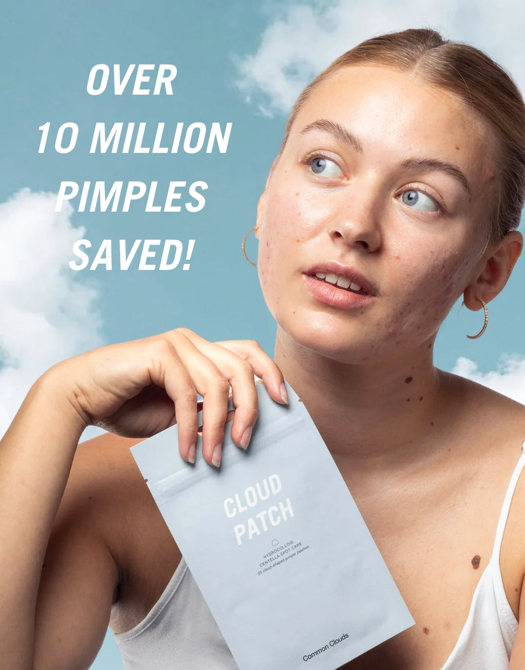 Cloud Patch - Pimple Patch