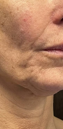 Emma, 52